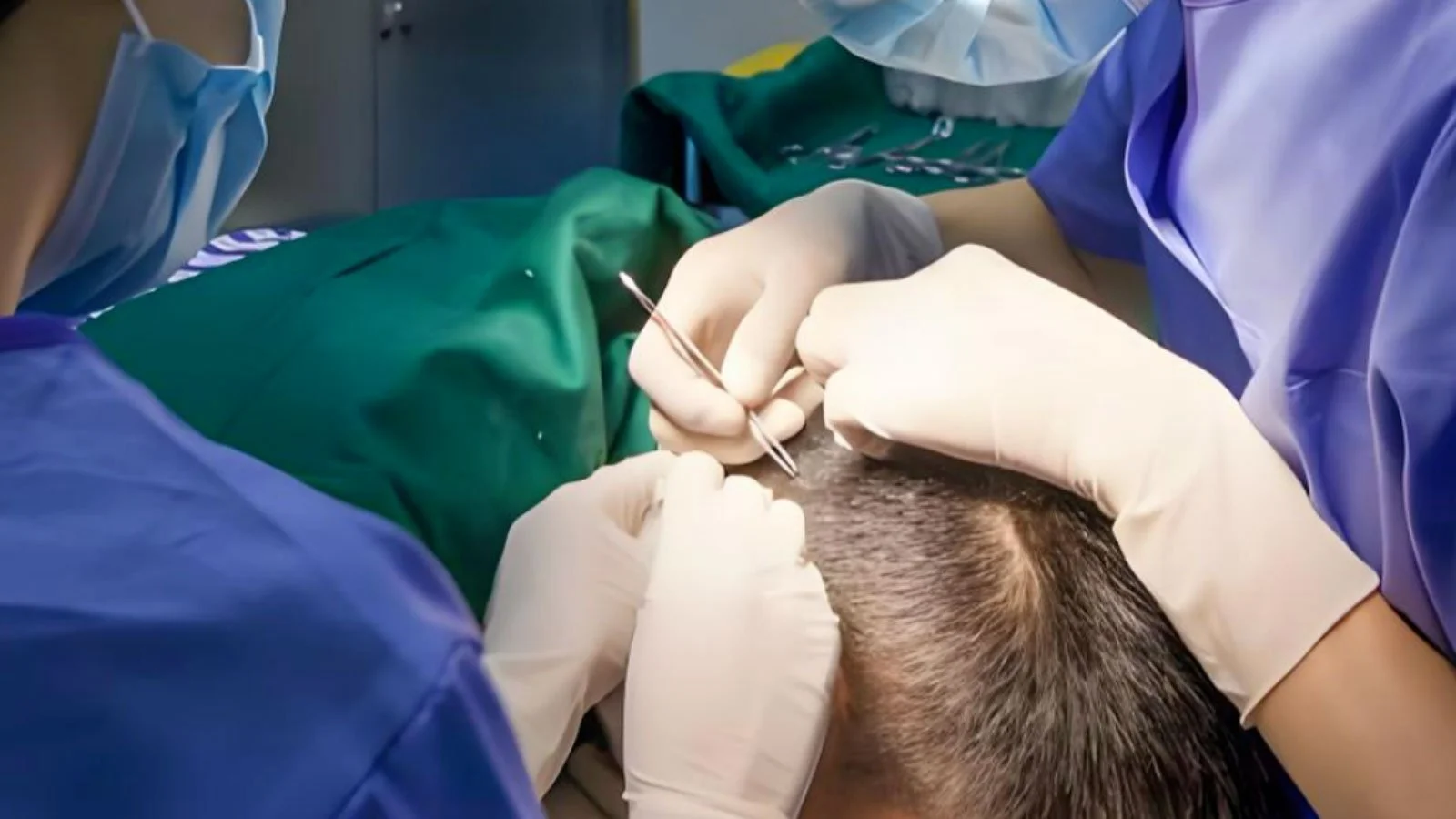 Harvesting Hair Follicles